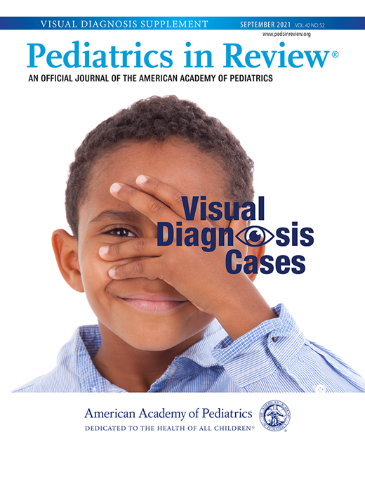 Periorbital Mass in a 2monthold Girl Pediatrics In Review